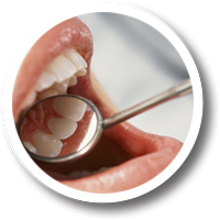 teeth diagnosis - check ups, DentalPlus