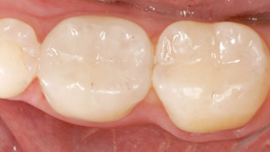 Ethical and pain-free dental care, DentalPlus Tauranga