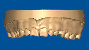 Ethical and pain-free dental care, DentalPlus Tauranga