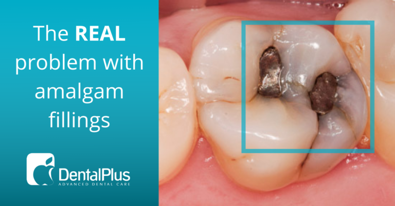 Read more about the article The REAL problem with Amalgam fillings